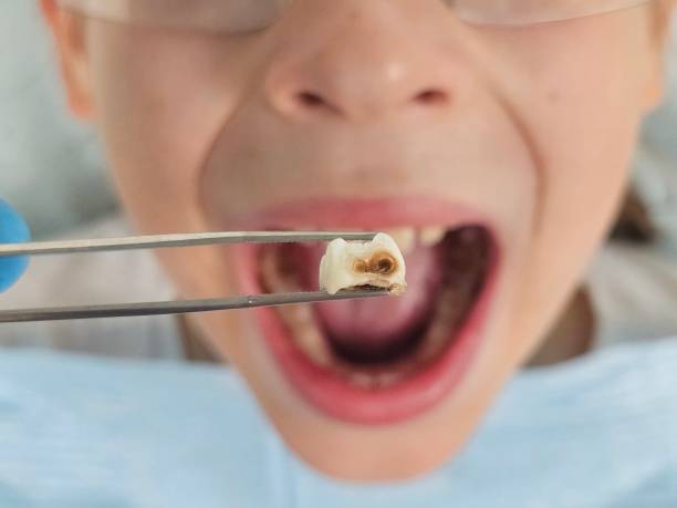 Best Weekend Emergency Dentist in Glen Allen, VA